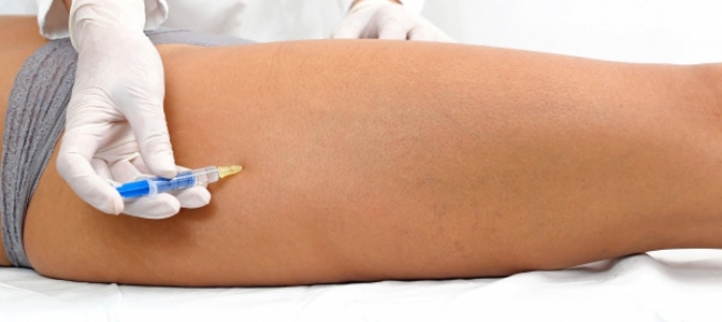 mesoterapia con ozono per dimagrire